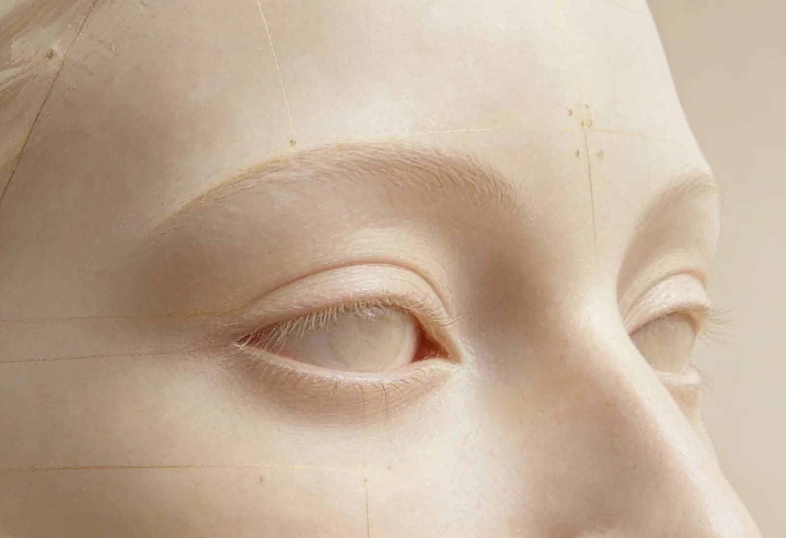 Blefaroplastia — Mirada